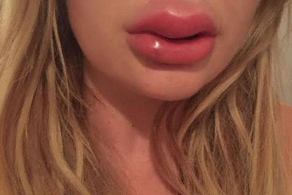 lpg‘：’炼厂检修逐步恢复 8月商品量环比增加